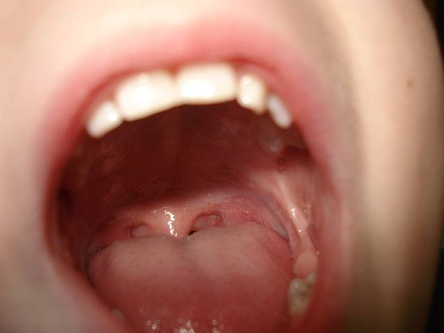 Munddusche und Mandelsteine – ein Ratgeber | ExpertenTesten.de