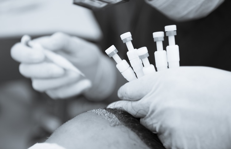 DHI Haartransplantation Türkei